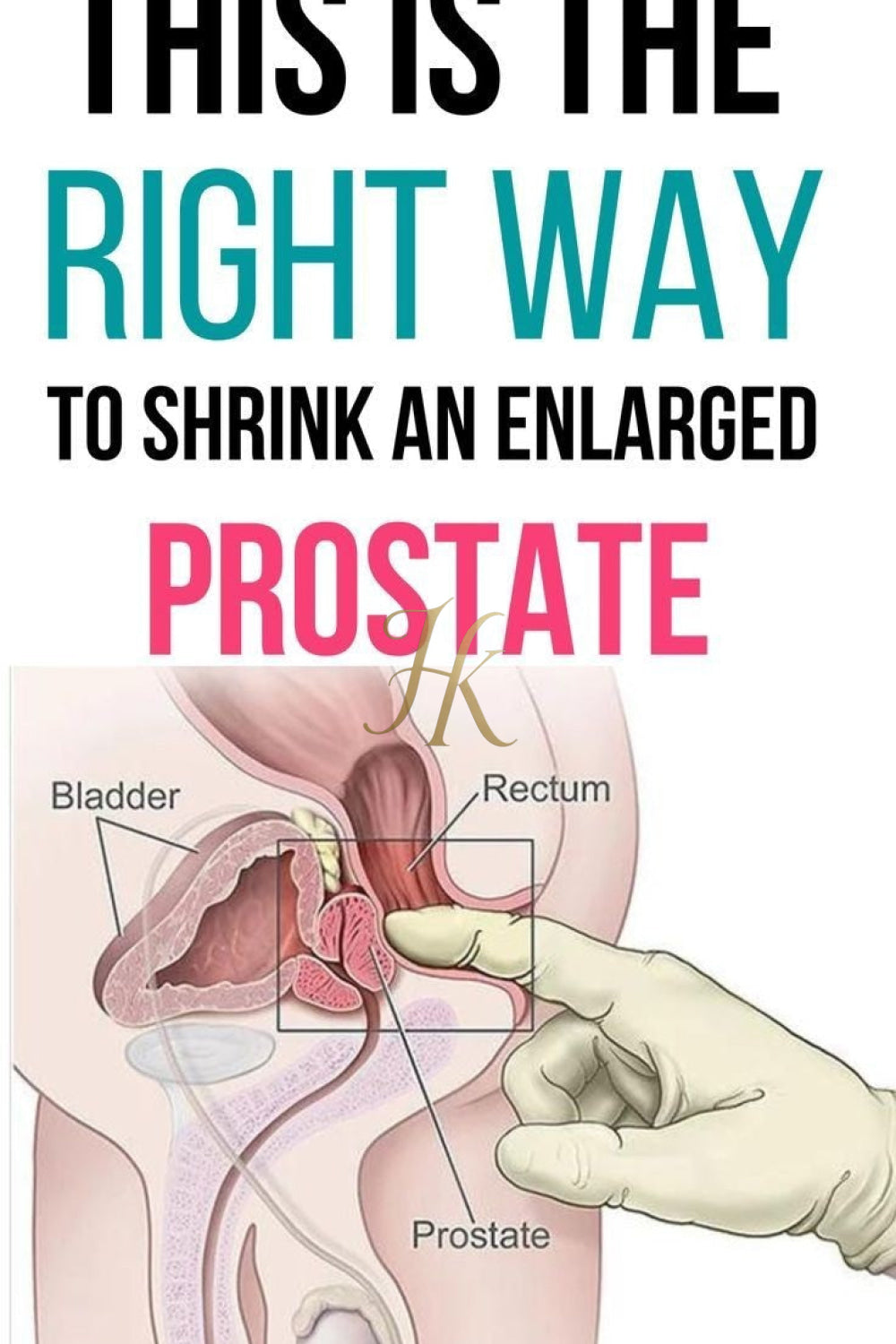 Male Prostate Massage Vibrator - kayibstrore